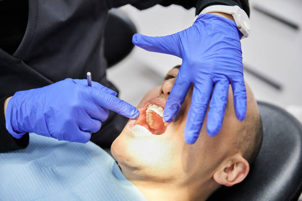 Best Emergency Dentist for Lost Fillings or Crowns in Barnum Island, NY